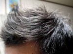 AGA治療104日目　ミノタブ中止2週間後の頭髪【写真あり】