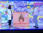 AGA治療1414日目　ヘアメディカルの浜中医師がテレビに出てました