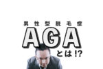 AGA（男性型脱毛症）とは？